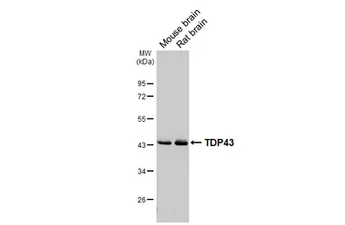 Anti-TDP43 antibody [HL5702] used in Western Blot (WB). GTX646533