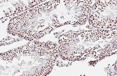 Anti-TDP43 antibody [HL5704] used in IHC (Paraffin sections) (IHC-P). GTX646535