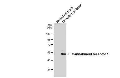 Anti-Cannabinoid receptor 1 antibody [HL5708] used in Western Blot (WB). GTX646539