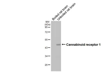 Anti-Cannabinoid receptor 1 antibody [HL5708] used in Western Blot (WB). GTX646539