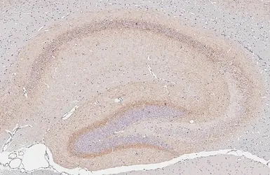 Anti-Cannabinoid receptor 1 antibody [HL5708] used in IHC (Paraffin sections) (IHC-P). GTX646539