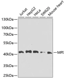 Anti-MPI antibody used in Western Blot (WB). GTX64661