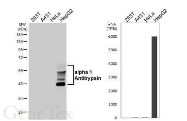Anti-alpha 1 Antitrypsin antibody [HL5724] used in Western Blot (WB). GTX646675