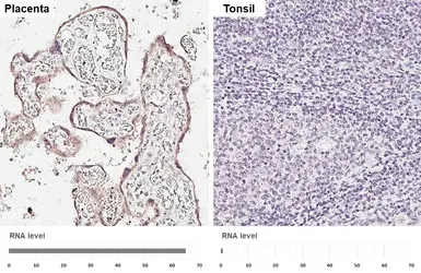 Anti-Placensin / FBN2 antibody [HL5732] used in IHC (Paraffin sections) (IHC-P). GTX646683