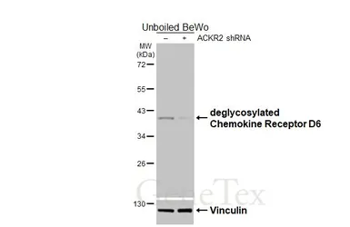 Anti-Chemokine Receptor D6 antibody [HL5734] used in Western Blot (WB). GTX646685