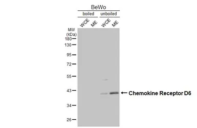 Anti-Chemokine Receptor D6 antibody [HL5734] used in Western Blot (WB). GTX646685