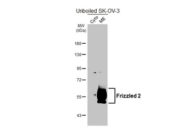 Anti-Frizzled 2 antibody [HL5743] used in Western Blot (WB). GTX646694