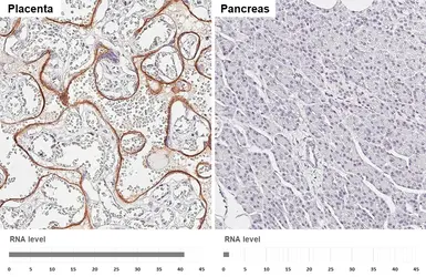 Anti-CD71 antibody [HL5775] used in IHC (Paraffin sections) (IHC-P). GTX646846