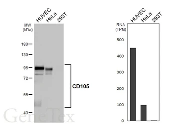 Anti-CD105 antibody [HL5782] used in Western Blot (WB). GTX646853