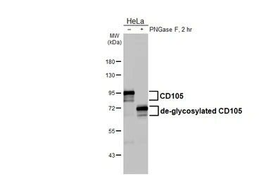 Anti-CD105 antibody [HL5782] used in Western Blot (WB). GTX646853