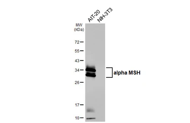Anti-alpha MSH antibody [HL5798] used in Western Blot (WB). GTX646869