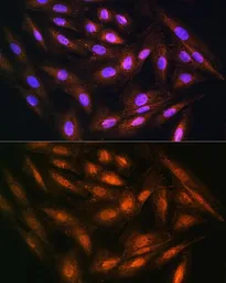 Anti-DUSP14 antibody used in Immunocytochemistry/ Immunofluorescence (ICC/IF). GTX64689