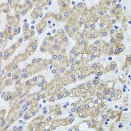 Anti-ACP1 antibody used in IHC (Paraffin sections) (IHC-P). GTX64698