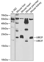 Anti-NCE2 antibody used in Western Blot (WB). GTX64701