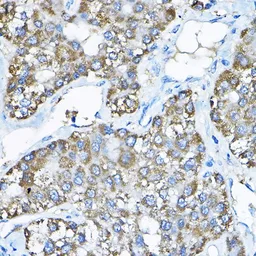 Anti-NCE2 antibody used in IHC (Paraffin sections) (IHC-P). GTX64701