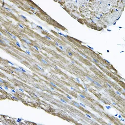 Anti-NCE2 antibody used in IHC (Paraffin sections) (IHC-P). GTX64701