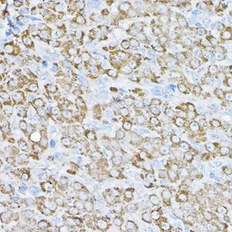 Anti-NCE2 antibody used in IHC (Paraffin sections) (IHC-P). GTX64701