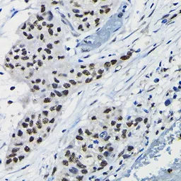 Anti-DRIL1 antibody used in IHC (Paraffin sections) (IHC-P). GTX64706
