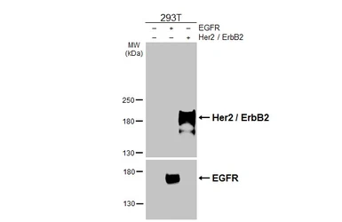 Anti-Her2 / ErbB2 antibody [HL5814] used in Western Blot (WB). GTX647132