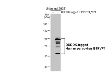 Anti-Human parvovirus B19 VP1 antibody [HL5827] used in Western Blot (WB). GTX647145