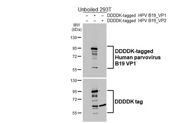 Anti-Human parvovirus B19 VP1 antibody [HL5828] used in Western Blot (WB). GTX647146
