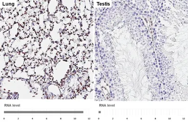 Anti-NFIB antibody [HL5837] used in IHC (Paraffin sections) (IHC-P). GTX647155