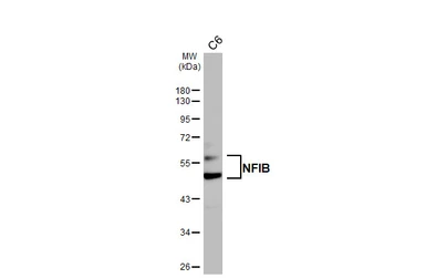 Anti-NFIB antibody [HL5837] used in Western Blot (WB). GTX647155