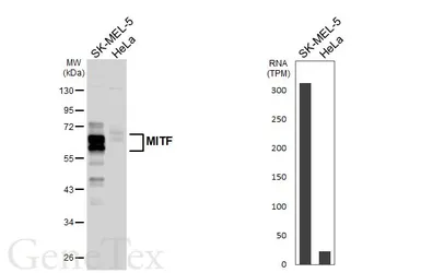 Anti-MITF antibody [HL5838] used in Western Blot (WB). GTX647156