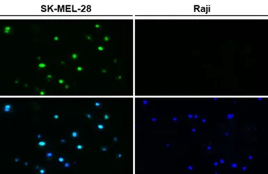 Anti-MITF antibody [HL5838] used in IHC-P (cell pellet) (IHC-P (cell pellet)). GTX647156