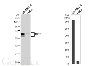 Anti-MITF antibody [HL5839] used in Western Blot (WB). GTX647157