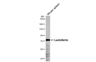 Anti-Lactoferrin antibody [HL5843] used in Western Blot (WB). GTX647161