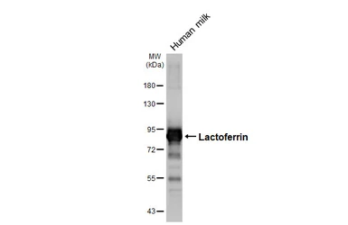 Anti-Lactoferrin antibody [HL5843] used in Western Blot (WB). GTX647161