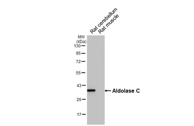 Anti-Aldolase C antibody [HL5849] used in Western Blot (WB). GTX647167