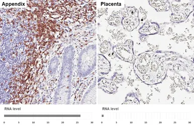 Anti-CD2 antibody [HL5859] used in IHC (Paraffin sections) (IHC-P). GTX647183
