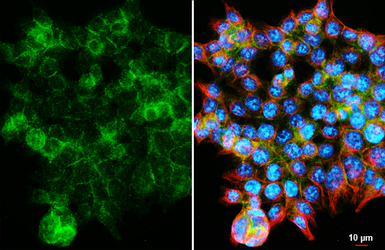 Anti-CD9 antibody [HL5881] used in Immunocytochemistry/ Immunofluorescence (ICC/IF). GTX647205