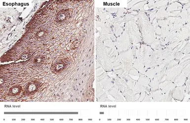 Anti-CD9 antibody [HL5882] used in IHC (Paraffin sections) (IHC-P). GTX647206