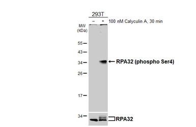Anti-RPA32 (phospho Ser4) antibody [HL5883] used in Western Blot (WB). GTX647207