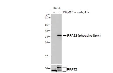 Anti-RPA32 (phospho Ser4) antibody [HL5883] used in Western Blot (WB). GTX647207