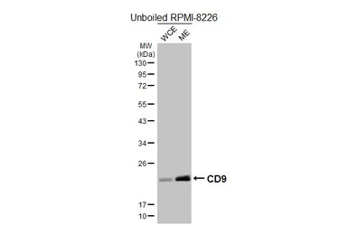 Anti-CD9 antibody [HL5888] used in Western Blot (WB). GTX647212