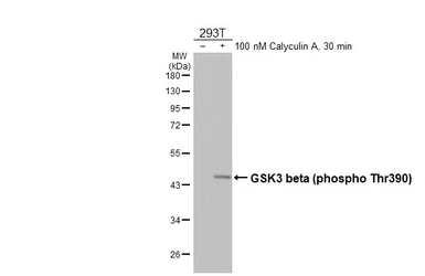 Anti-GSK3 beta (phospho Thr390) antibody [HL5893] used in Western Blot (WB). GTX647217