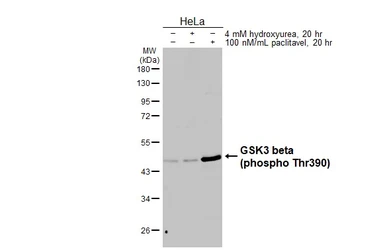 Anti-GSK3 beta (phospho Thr390) antibody [HL5893] used in Western Blot (WB). GTX647217
