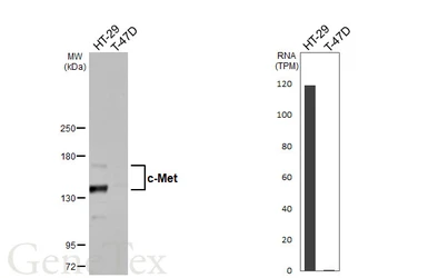 Anti-c-Met antibody [HL5898] used in Western Blot (WB). GTX647222