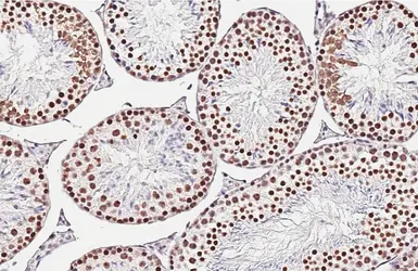 Anti-Nucleophosmin antibody [HL5905] used in IHC (Paraffin sections) (IHC-P). GTX647229