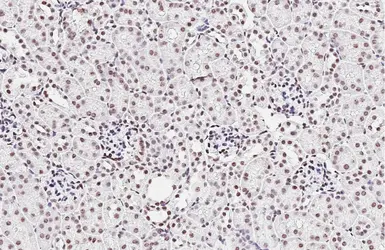 Anti-Nucleophosmin antibody [HL5905] used in IHC (Paraffin sections) (IHC-P). GTX647229