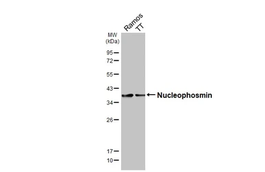 Anti-Nucleophosmin antibody [HL5905] used in Western Blot (WB). GTX647229