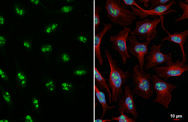 Anti-Nucleophosmin antibody [HL5905] used in Immunocytochemistry/ Immunofluorescence (ICC/IF). GTX647229