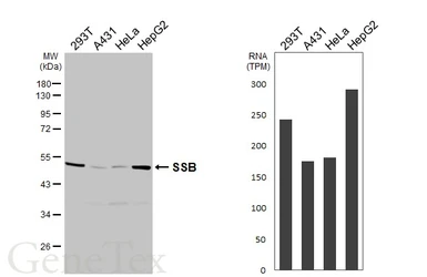Anti-SSB antibody [HL5907] used in Western Blot (WB). GTX647232