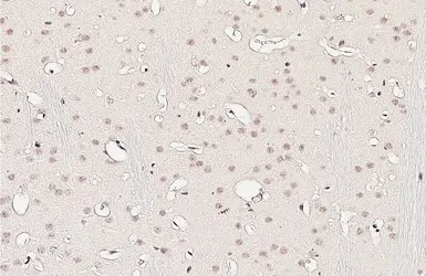 Anti-SSB antibody [HL5907] used in IHC (Paraffin sections) (IHC-P). GTX647232
