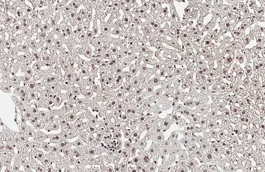 Anti-SSB antibody [HL5907] used in IHC (Paraffin sections) (IHC-P). GTX647232