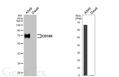Anti-CD155 antibody [HL5910] used in Western Blot (WB). GTX647235
